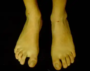 First toe is longer than the others and  wide space between  first and second toe.