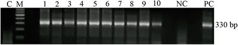 Trypanosoma cruzi by PCR in fecal samples of human xenodiagnosis