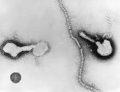 Transmission electron micrograph of a parainfluenza virus. Two intact particles and free filamentous nucleocapsid