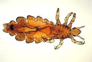 Optical microscopy image of a female head louse.