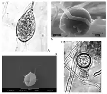 Water mould - Phytophthora forms: A: Sporangia. B: Zoospore. C: Chlamydospore. D: Oospore