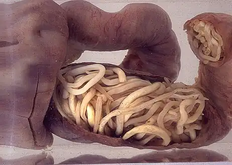 Piece of intestine, blocked by worms, surgically removed from a 3-year-old boy in South Africa.