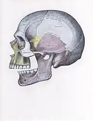 Side view of the skull with posterior dislocation of jaw.