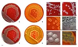 Pseudomonas aeruginos colonies on blood agar
