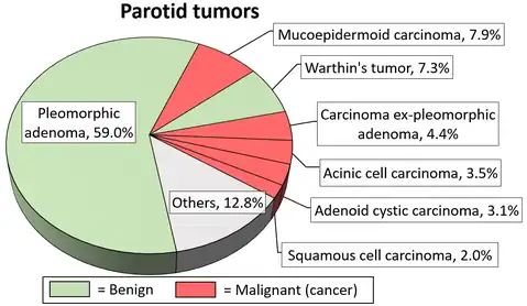 Relative incidence of parotid tumors, showing mucoepidermoid carcinoma at top right.