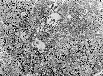 TEM micrograph of tissue infected with Rift Valley fever virus