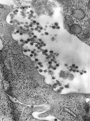 Negatively-stained transmission electron micrograph  reveals the presence of Rubella virus virions