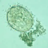 Schistosoma mekongi