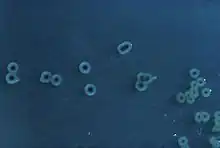 "S. enterica" Typhimurium colonies on a Hektoen enteric agar plate