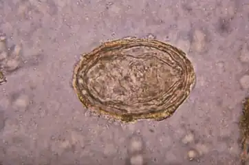 Schistosoma japonicum