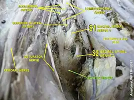 Sciatic nerve.