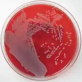 Off-white colonies of bacteria growing on a blood agar plate