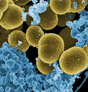 Staphylococcus aureus, the most common microorganism associated with vertebral osteomyelitis