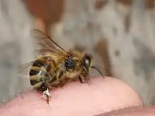 Bee sting. The stinger is torn off and left in the skin.