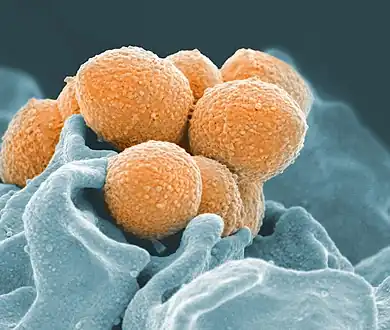 False-color scanning electron microscope image of Streptococcus pyogenes (orange) during phagocytosis with a human neutrophil