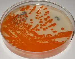 Streptococcus agalactiae on granada agar, anaerobic incubation