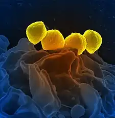 Scanning electron micrograph of Streptococcus pyogenese bacteria yellow bound to a human neutrophil blue