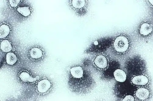 Transmission electron micrograph of organ cultured coronavirus OC43