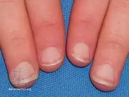 Terry's nails