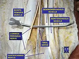 Tibial and common peroneal nerve (aka common fibular nerve)