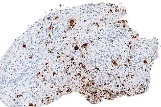 High magnification micrograph of toxoplasmosis