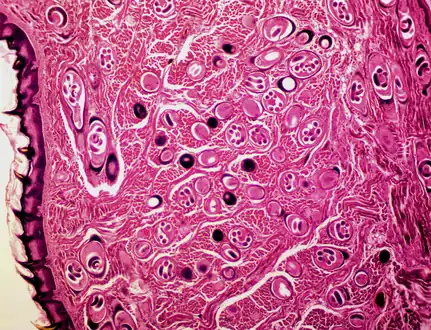 Animal tissue infected with the parasite that causes the disease trichinosis: Most parasites are shown in cross section, but some randomly appear in long section.