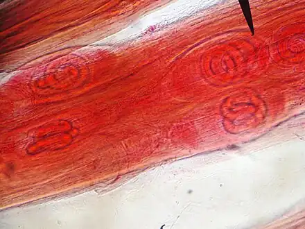 T. spiralis larvae within the diaphragm muscle of a pig
