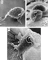T. vaginalis protozoa.SEM