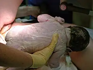 Baby held in a gloved hand, with creamy substance smeared all over