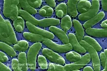 False-color SEM image of "Vibrio vulnificus"