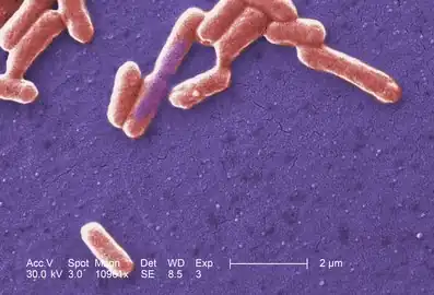 Escherichia coli O157-H7 CDC