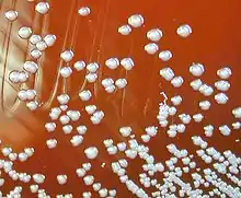 "Burkholderia pseudomallei" colonies on a blood agar plate