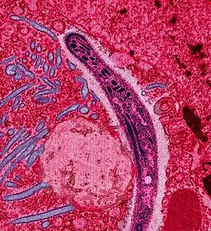 False-colored electron micrograph of a sporozoite