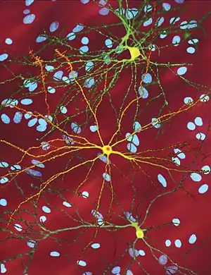 Several neurons colored yellow and having a large central core with up to two dozen tendrils branching out of them, the core of the neuron in the foreground contains an orange blob about a quarter of its diameter