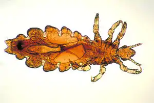 Optical microscopy image of a female head louse.