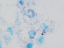 "Rickettsia conorii" observed in Vero cells (red rods; magnification ×1,000)