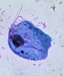 "T. vaginalis" stained