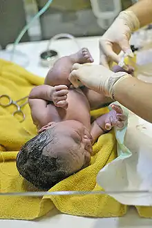 Newborn on yellow blanket being attended to by a nurse