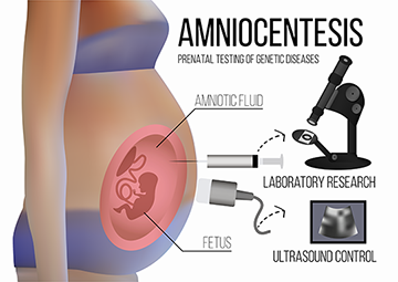 Amniocyte