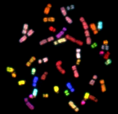 Spectral Karyotype (SKY)