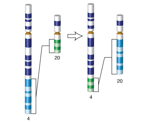 Translocation