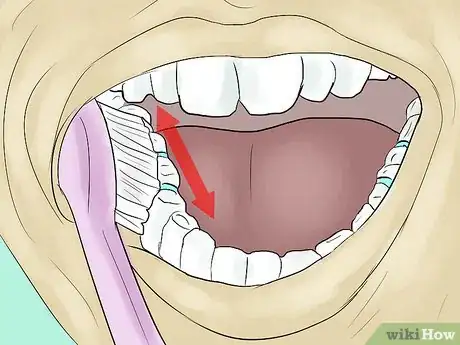 Image titled Eat With Separators in Your Mouth Step 11