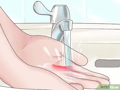 Image titled Quickly Treat a Cut or Bleeding Scrape Step 1