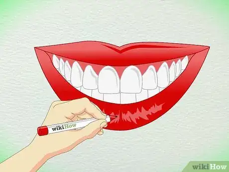 Image titled Draw Teeth Step 11
