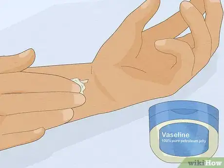 Image titled Remove Super Glue from Your Skin (Petroleum Jelly Method) Step 4
