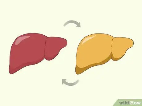 Image titled Treat Liver Fibrosis Step 2