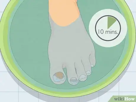 Image titled Treat Toe Nail Fungus Step 2