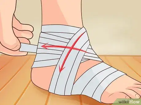 Image titled Wrap an Ankle Step 10
