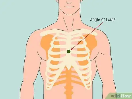 Image titled Put ECG Leads on a Chest Step 5