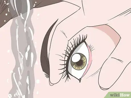 Image titled Stop Watery Eyes Step 1